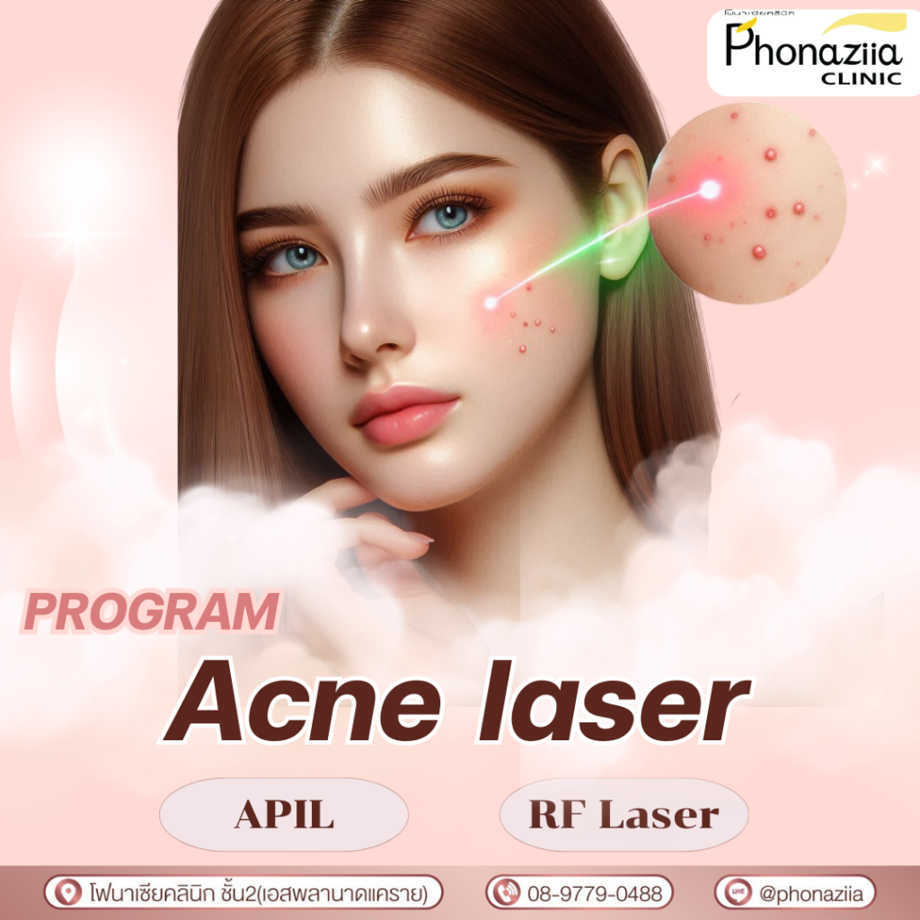 Phonaziiaclinic Laser Program