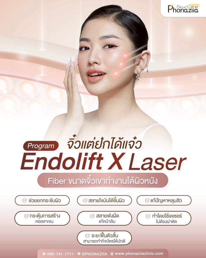 ENDOLIFTX Phonaziiaclinic